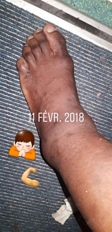 «كوفي» ينشر صورة لإصابته في مباراة جرين بافلوز.. صورة