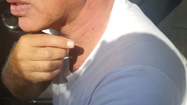 أيمن يونس بعد الاعتداء